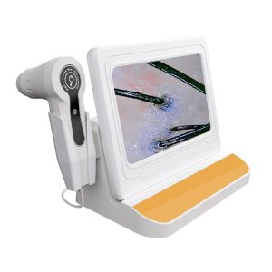 High-quality Portable High-definition Screen Anti-hair Loss Scalp Detector Beauty Parlour Professional Hair Analyzer