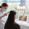scalp-analysis-device-tri-spectrum-scalp-hair-follicle-det-02 scalp-analysis-device-tri-spectrum-scalp-hair-follicle-det-02